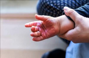 Maranhão registra 126 casos de queimaduras em crianças