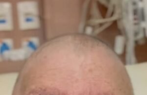 Em tratamento contra câncer, Roseana contrai pneumonia e vai se submeter à cirurgia